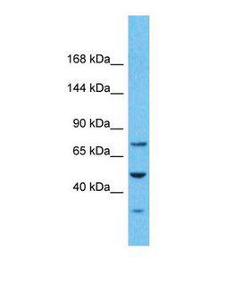 PKD2 / Polycystin 2 Antibody - Western blot of Human Stomach Tumor. PKD2 antibody dilution 1.0 ug/ml.  This image was taken for the unconjugated form of this product. Other forms have not been tested.