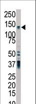 PKD2 / Polycystin 2 Antibody - The anti-PKD2 antibody is used in Western blot to detect PKD2 in HL-60 cell lysate.