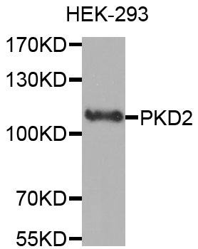 PKD2 / Polycystin 2 Antibody - Western blot analysis of extracts of HEK-293 cell line, using PKD2 antibody.