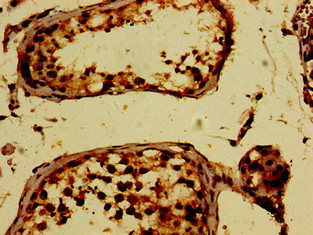 PKD2 / Polycystin 2 Antibody - Immunohistochemistry image of paraffin-embedded human testis tissue at a dilution of 1:100