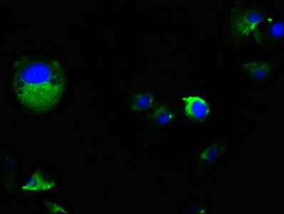 PKD2 / Polycystin 2 Antibody - Immunofluorescence staining of MCF-7 cells with PKD2 Antibody at 1:100, counter-stained with DAPI. The cells were fixed in 4% formaldehyde, permeabilized using 0.2% Triton X-100 and blocked in 10% normal Goat Serum. The cells were then incubated with the antibody overnight at 4°C. The secondary antibody was Alexa Fluor 488-congugated AffiniPure Goat Anti-Rabbit IgG(H+L).