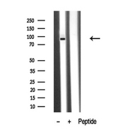 PKD2 / Polycystin 2 Antibody - Western blot analysis of extracts of human kidney tissue sample using PKD2 antibody.
