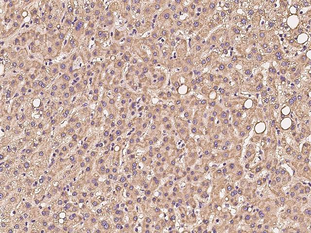 PKD2L2 Antibody - Immunochemical staining of human PKD2L2 in human liver with rabbit polyclonal antibody at 1:100 dilution, formalin-fixed paraffin embedded sections.