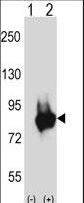 PKD3 / PRKD3 Antibody - Western blot of Prkd3 (arrow) using rabbit polyclonal Mouse Prkd3 Antibody. 293 cell lysates (2 ug/lane) either nontransfected (Lane 1) or transiently transfected (Lane 2) with the Prkd3 gene.