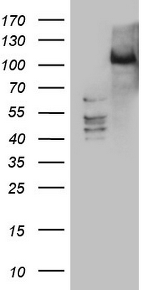 PKD3 / PRKD3 Antibody - HEK293T cells were transfected with the pCMV6-ENTRY control (Left lane) or pCMV6-ENTRY PRKD3 (Right lane) cDNA for 48 hrs and lysed. Equivalent amounts of cell lysates (5 ug per lane) were separated by SDS-PAGE and immunoblotted with anti-PRKD3.