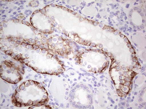 PKD3 / PRKD3 Antibody - Immunohistochemical staining of paraffin-embedded Human Kidney tissue within the normal limits using anti-PRKD3 mouse monoclonal antibody.  heat-induced epitope retrieval by 1 mM EDTA in 10mM Tris, pH8.5, 120C for 3min)