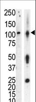 PKD3 / PRKD3 Antibody - Western blot of anti-PKC nu antibody in lysate of HL60 cells stimulated with PMA (lane A) and mouse brain tissue lysate (lane B). PKC nu (arrow) was detected using purified antibody. Secondary HRP-anti-rabbit was used for signal visualization with chemiluminescence.