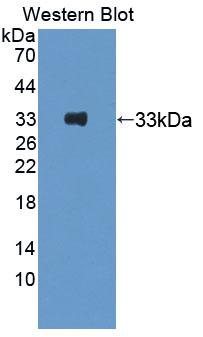 PKD3 / PRKD3 Antibody - Western blot of PKD3 / PRKD3 antibody.