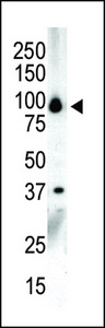 PKD3 / PRKD3 Antibody - Western blot of anti-PKC nu C-term antibody in NCI-H460 cell lysate. PKC nu (arrow) was detected using purified antibody. Secondary HRP-anti-rabbit was used for signal visualization with chemiluminescence.