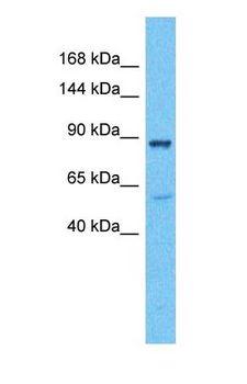 PKD3 / PRKD3 Antibody - Western blot of KPCD3 Antibody with human Fetal Liver lysate.  This image was taken for the unconjugated form of this product. Other forms have not been tested.