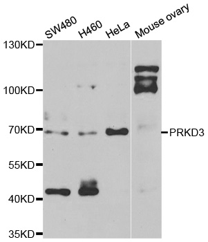 PKD3 / PRKD3 Antibody - Western blot analysis of extracts of various cell lines.