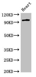 PKD3 / PRKD3 Antibody - Western Blot Positive WB detected in:Rat heart tissue All Lanes:PRKD3 antibody at 3µg/ml Secondary Goat polyclonal to rabbit IgG at 1/50000 dilution Predicted band size: 101,69 KDa Observed band size: 101 KDa