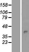 PKDCC / SGK493 Protein - Western validation with an anti-DDK antibody * L: Control HEK293 lysate R: Over-expression lysate