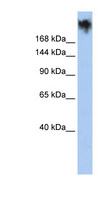 PKDREJ Antibody - PKDREJ antibody Western blot of HepG2 cell lysate. This image was taken for the unconjugated form of this product. Other forms have not been tested.