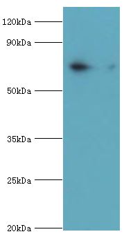 PKG / PRKG1 Antibody - Western blot. All lanes: cGMP-dependent protein kinase 1 antibody at 3 ug/ml+mouse lung tissue. Secondary antibody: Goat polyclonal to rabbit at 1:10000 dilution. Predicted band size: 76 kDa. Observed band size: 76 kDa.