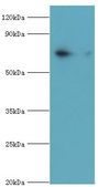 PKG / PRKG1 Antibody - Western blot. All lanes: cGMP-dependent protein kinase 1 antibody at 3 ug/ml+mouse lung tissue. Secondary antibody: Goat polyclonal to rabbit at 1:10000 dilution. Predicted band size: 76 kDa. Observed band size: 76 kDa.