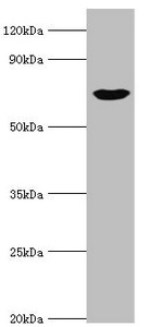 PKG / PRKG1 Antibody - Western blot All lanes: cGMP-dependent protein kinase 1 antibody at 3µg/ml + Mouse lung tissue Secondary Goat polyclonal to rabbit IgG at 1/10000 dilution Predicted band size: 77, 78, 45 kDa Observed band size: 77 kDa