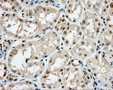 PKG / PRKG1 Antibody - IHC of paraffin-embedded Kidney tissue using anti-PRKG1 mouse monoclonal antibody. (Dilution 1:50).