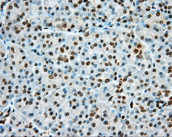PKG / PRKG1 Antibody - IHC of paraffin-embedded pancreas tissue using anti-PRKG1 mouse monoclonal antibody. (Dilution 1:50).