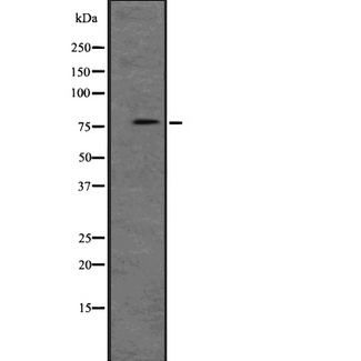 PKG / PRKG1 Antibody - Western blot analysis of PRKG1 expression in NIH3T3 whole cells lysate. The lane on the left is treated with the antigen-specific peptide.