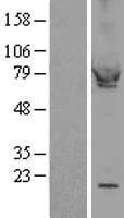 PKG / PRKG1 Protein - Western validation with an anti-DDK antibody * L: Control HEK293 lysate R: Over-expression lysate