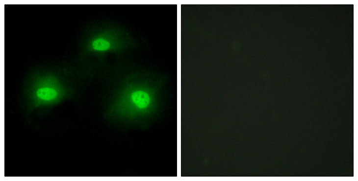 PKIA Antibody - Immunofluorescence analysis of HeLa cells, using IPKA Antibody. The picture on the right is blocked with the synthesized peptide.
