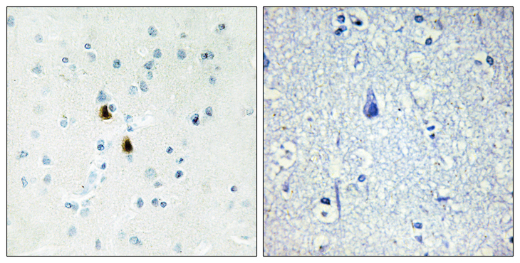 PKIA Antibody - Immunohistochemistry analysis of paraffin-embedded human brain tissue, using IPKA Antibody. The picture on the right is blocked with the synthesized peptide.