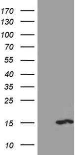 PKIA Antibody - HEK293T cells were transfected with the pCMV6-ENTRY control. (Left lane) or pCMV6-ENTRY PKIA. (Right lane) cDNA for 48 hrs and lysed. Equivalent amounts of cell lysates. (5 ug per lane) were separated by SDS-PAGE and immunoblotted with anti-PKIA. (1:2000)