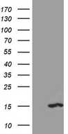 PKIA Antibody - HEK293T cells were transfected with the pCMV6-ENTRY control. (Left lane) or pCMV6-ENTRY PKIA. (Right lane) cDNA for 48 hrs and lysed. Equivalent amounts of cell lysates. (5 ug per lane) were separated by SDS-PAGE and immunoblotted with anti-PKIA. (1:2000)