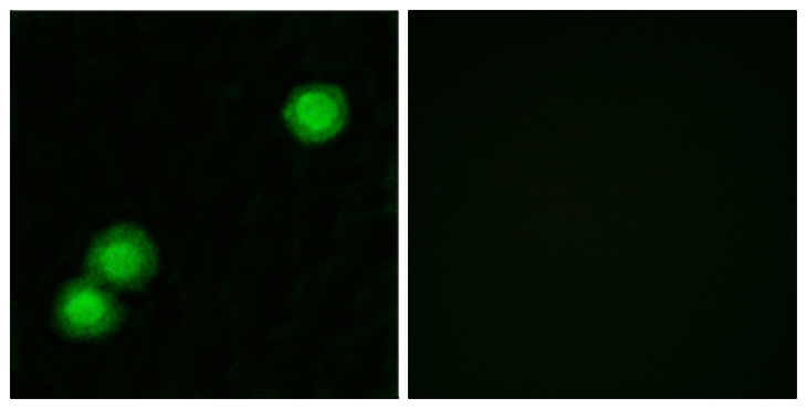 PKIB Antibody - Immunofluorescence analysis of MCF7 cells, using IPKB Antibody. The picture on the right is blocked with the synthesized peptide.