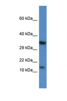 PKIB Antibody - PKIB antibody Western blot of Rat Kidney lysate. Antibody concentration 1 ug/ml. This image was taken for the unconjugated form of this product. Other forms have not been tested.
