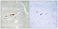 PKIB Antibody - Peptide - + Immunohistochemistry analysis of paraffin-embedded human brain tissue, using IPKB antibody.
