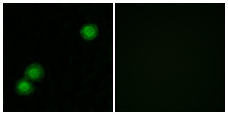 PKIB Antibody - Peptide - + Immunofluorescence analysis of MCF-7 cells, using IPKB antibody.