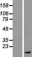 PKIB Protein - Western validation with an anti-DDK antibody * L: Control HEK293 lysate R: Over-expression lysate