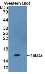 PKIG Antibody - Western blot of PKIG antibody.