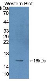 PKIG Antibody - Western Blot Sample: Recombinant PKIg, Human
