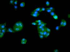 PKIG Antibody - Immunofluorescence staining of PC3 cells diluted at 1:133, counter-stained with DAPI. The cells were fixed in 4% formaldehyde, permeabilized using 0.2% Triton X-100 and blocked in 10% normal Goat Serum. The cells were then incubated with the antibody overnight at 4°C.The Secondary antibody was Alexa Fluor 488-congugated AffiniPure Goat Anti-Rabbit IgG (H+L).