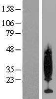 PKIG Protein - Western validation with an anti-DDK antibody * L: Control HEK293 lysate R: Over-expression lysate