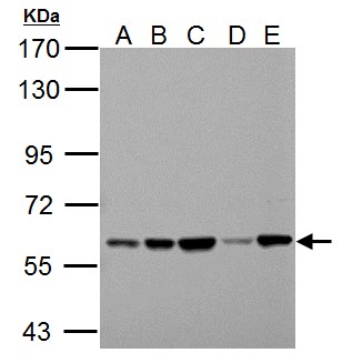 PKLR Antibody - Sample (30 ug of whole cell lysate). A:293T, B: A431, C: HeLa, D: HepG2, E: A375. 7.5% SDS PAGE. PKLR antibody diluted at 1:1000.