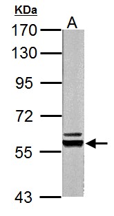 PKLR Antibody - Pyruvate Kinase (liver/RBC) antibody detects Pyruvate Kinase (liver/RBC) protein by Western blot analysis. A. 20 ug Rat liver lysate/extract. 7.5% SDS-PAGE. Pyruvate Kinase (liver/RBC) antibody dilution:1:10000.