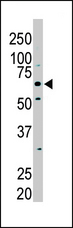 PKLR Antibody - The anti-PKLR antibody is used in Western blot to detect PKLR in NIH/3T3 cell lysate.