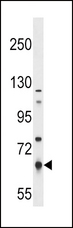 PKLR Antibody - PKLR Antibody (S8) western blot of NCI-H292 cell line lysates (35 ug/lane). The PKLR antibody detected the PKLR protein (arrow).