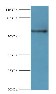 PKLR Antibody - Western blot. All lanes: Pklr antibody at 2 ug/ml+HeLa whole cell lysate. Secondary antibody: goat polyclonal to rabbit at 1:10000 dilution. Predicted band size: 62 kDa. Observed band size: 62 kDa.  This image was taken for the unconjugated form of this product. Other forms have not been tested.
