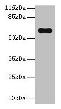 PKLR Antibody - Western blot All lanes: Pklr antibody at 2µg/ml + Hela whole cell lysate Secondary Goat polyclonal to rabbit IgG at 1/10000 dilution Predicted band size: 63, 59 kDa Observed band size: 63 kDa