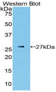 PKLR Antibody - Western blot of recombinant PKLR.  This image was taken for the unconjugated form of this product. Other forms have not been tested.