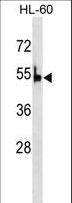 PKLR Antibody - PKLR Antibody (G536) western blot of HL-60 cell line lysates (35 ug/lane). The PKLR antibody detected the PKLR protein (arrow).