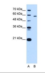 PKLR Antibody - Lane A: Marker. Lane B: HepG2 cell lysate. Antibody concentration: 5.0 ug/ml. Gel concentration: 12%.  This image was taken for the unconjugated form of this product. Other forms have not been tested.