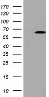 PKLR Antibody - HEK293T cells were transfected with the pCMV6-ENTRY control (Left lane) or pCMV6-ENTRY PKLR (Right lane) cDNA for 48 hrs and lysed. Equivalent amounts of cell lysates (5 ug per lane) were separated by SDS-PAGE and immunoblotted with anti-PKLR.