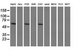 PKLR Antibody - Western blot of extracts (35 ug) from 9 different cell lines by using anti-PKLR monoclonal antibody.