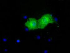PKLR Antibody - Anti-PKLR mouse monoclonal antibody  immunofluorescent staining of COS7 cells transiently transfected by pCMV6-ENTRY PKLR.